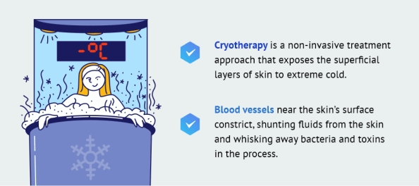 Cryotherapy for Eczema and Psoriasis
