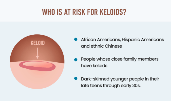 Who is at Risk for Keloids?