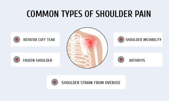 Common Types of Shoulder Pain
